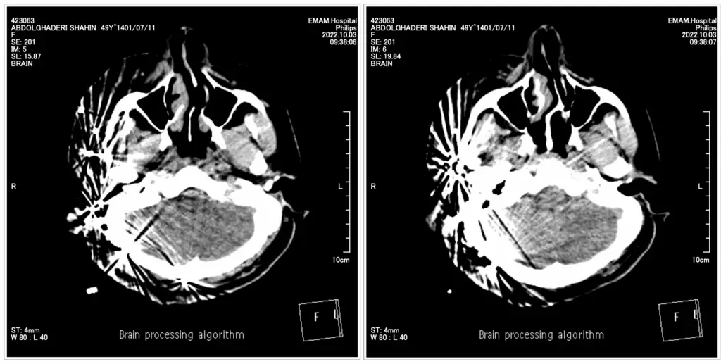 Medical image 4 of 5: Shahin Abdolghaderi’s injuries