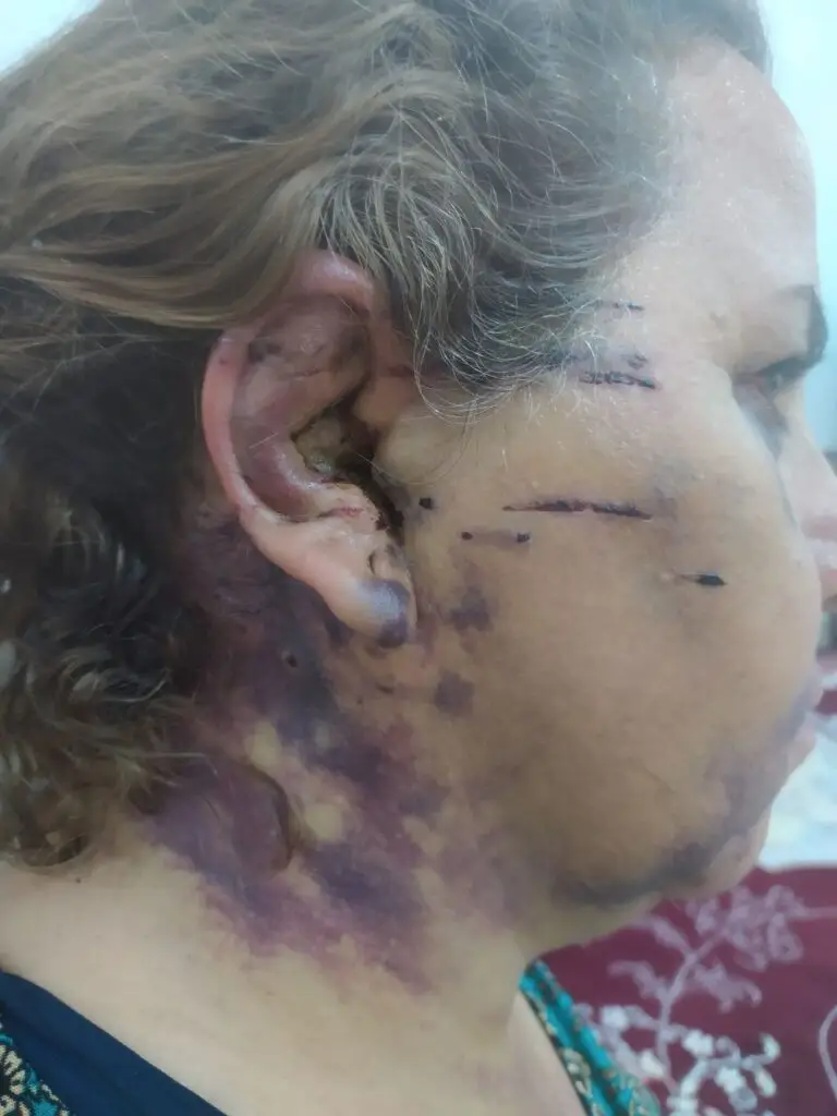 Medical image 2 of 5: Shahin Abdolghaderi’s injuries