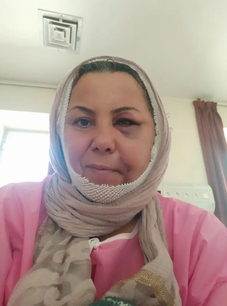 Medical image 1 of 5: Shahin Abdolghaderi’s injuries